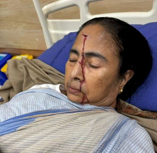 মাথায় চোট পেয়ে হাসপাতালে ভর্তি মমতা বন্দ্যোপাধ্যায়
